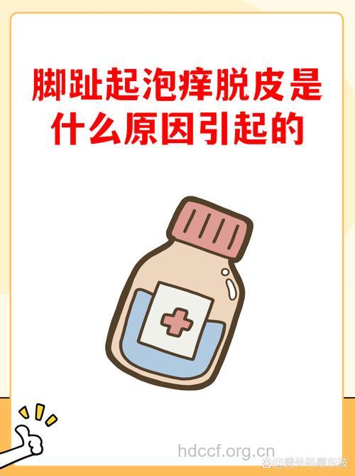 冬天穿鞋要防湿疹 四招帮你预防