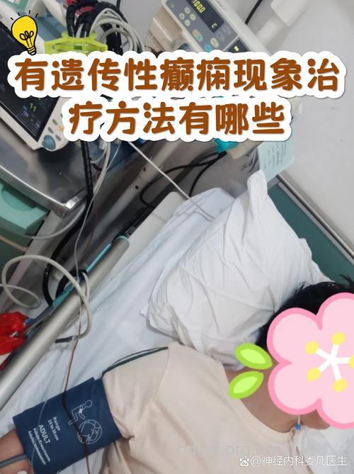 癫痫病有哪些遗传方式