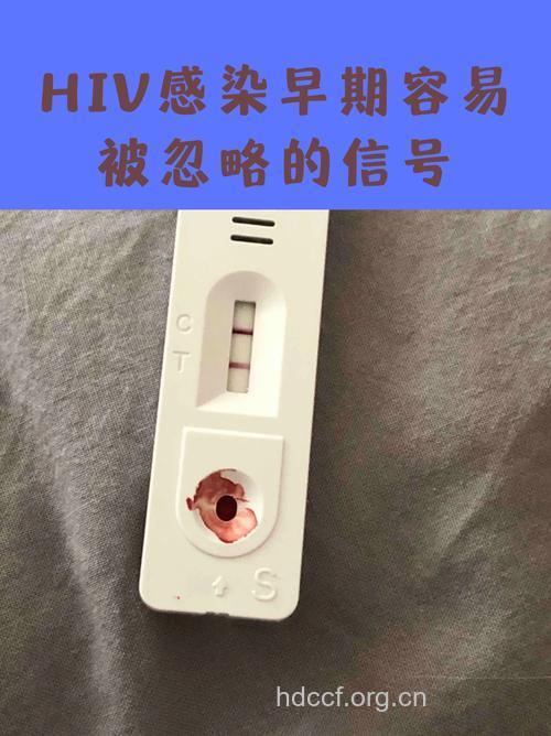 艾滋病试纸出现一条红线是什么意思