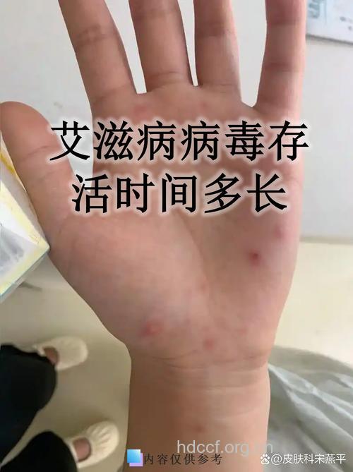 艾滋病病毒在水里存活率低