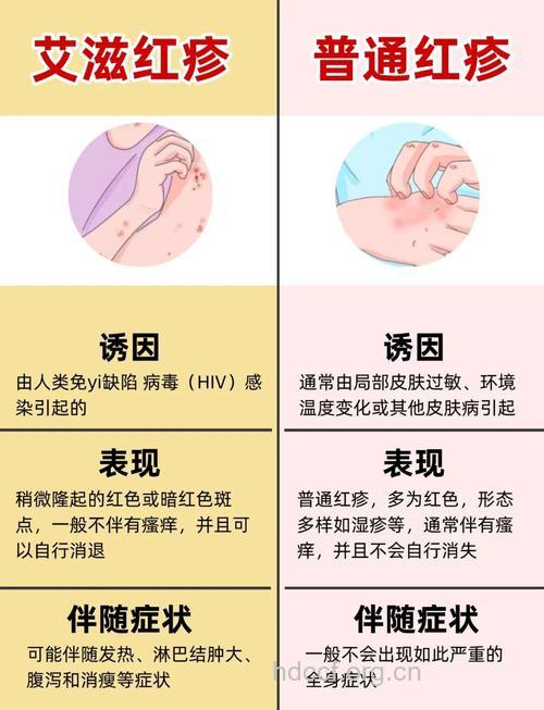艾滋病感染者的三种临床类型