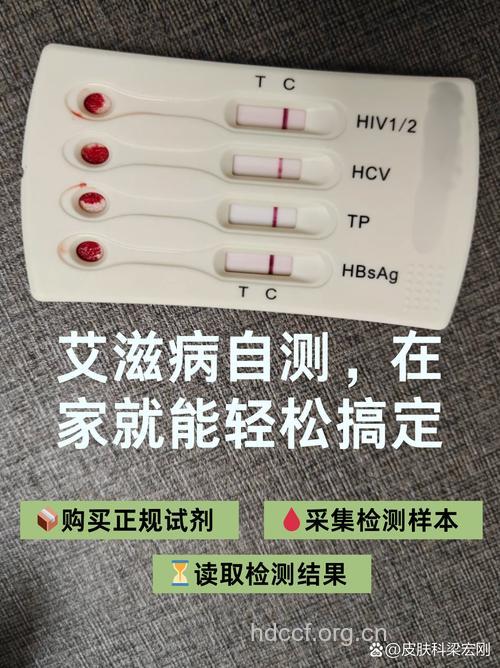 艾滋病检测 什么是金标法