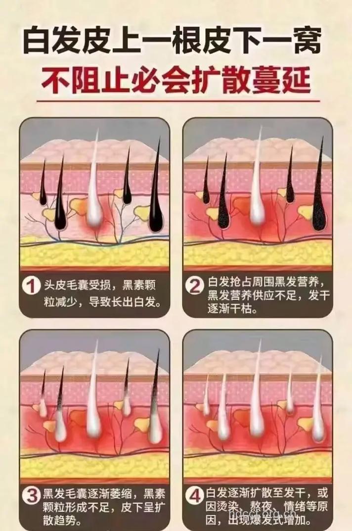 白发怎么样才能变黑