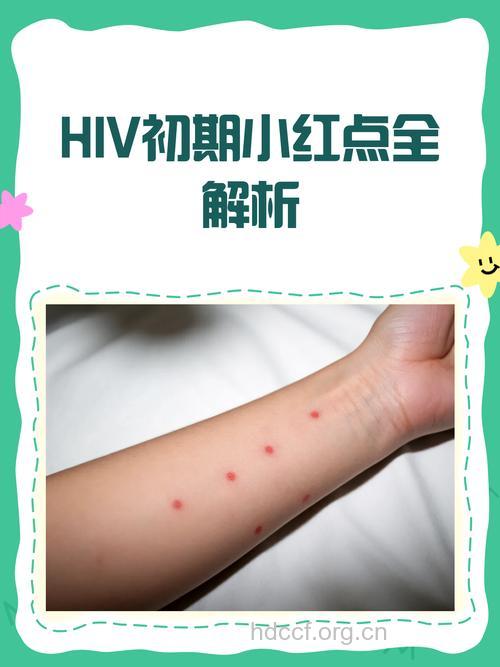 血液中HIV水平低的感染者传染性小