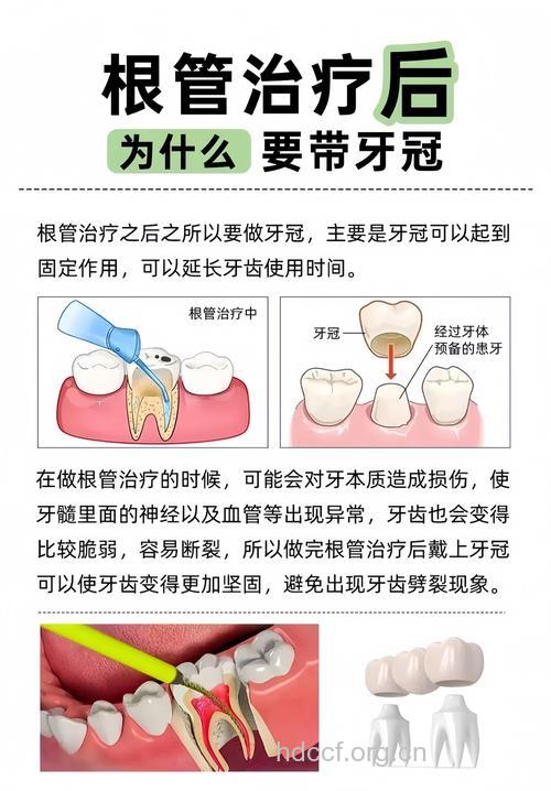 牙冠治疗 六种蛀牙的治疗方法