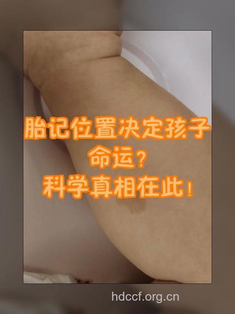 身体胎痣位置看命运吉凶