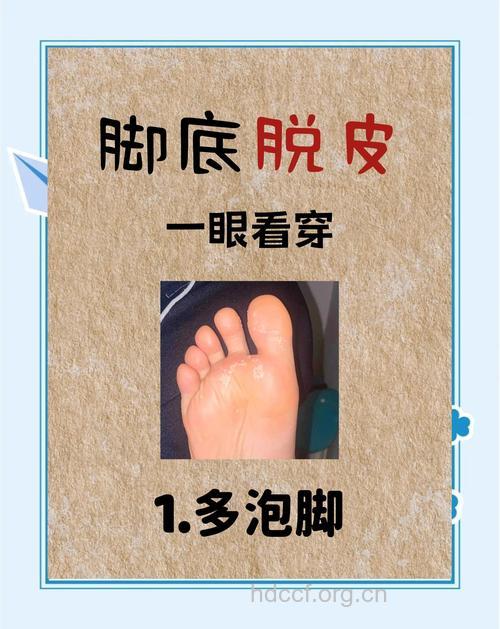 专家解释冬天脚底裂的原因