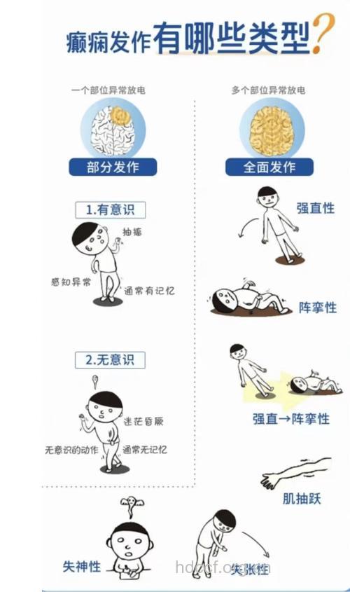 四大引发癫痫病的诱因