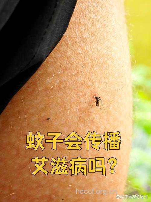 蚊子叮咬绝对不会得艾滋病