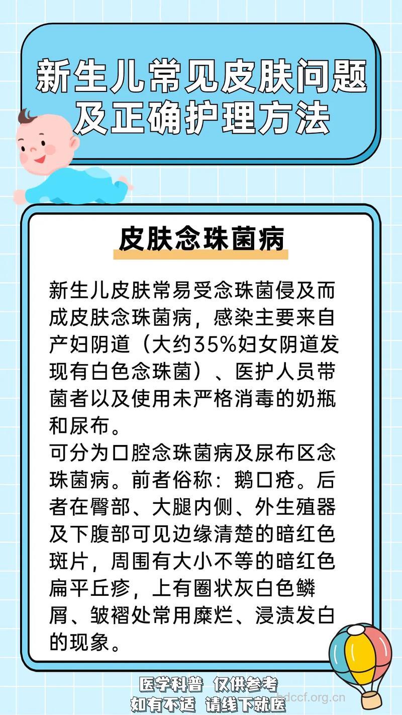 怎样防治婴儿皮肤念珠菌病