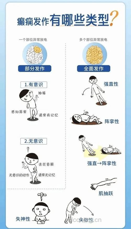 诱发癫痫的各种刺激因素