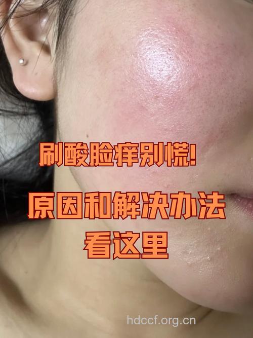 面部皮炎反复发作 化妆品惹祸