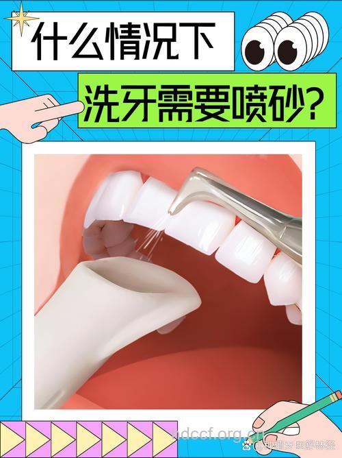 龋齿减痛疗法之“水喷雾”钻牙