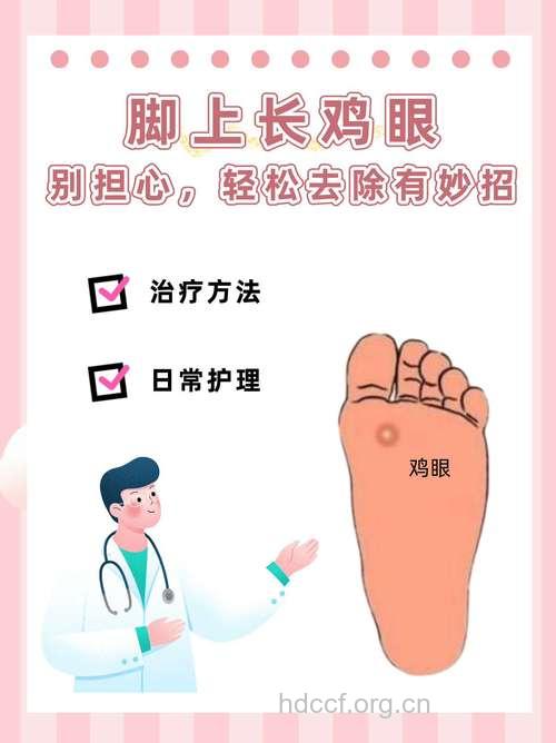 鸡眼引发的脚气怎么治疗