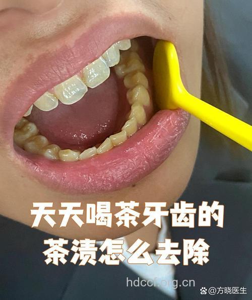 用茶水漱口可预防龋齿