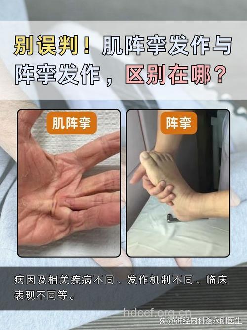癫痫肌阵挛和阵挛性发作有何区别