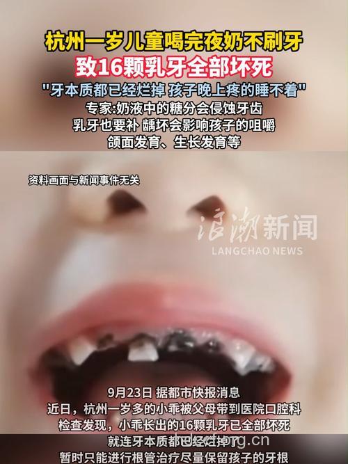 酸奶过量饮用易患蛀牙