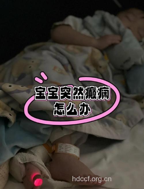 儿童癫痫发作是什么样的