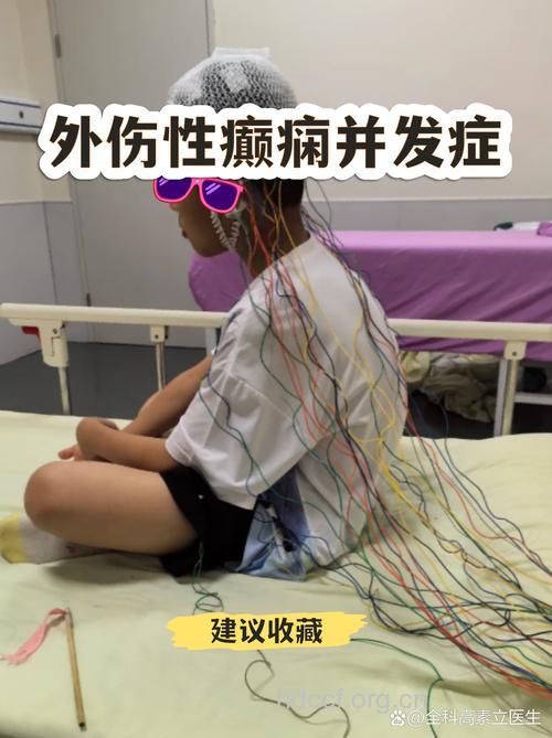 外伤性癫痫有什么并发症