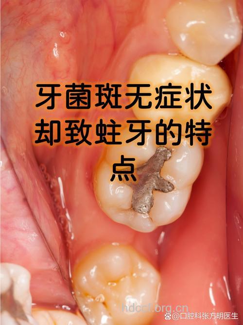 瓶装水加大蛀牙风险