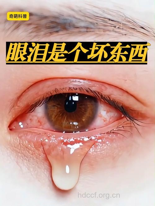 眼泪会传染艾滋病吗 流泪需谨慎