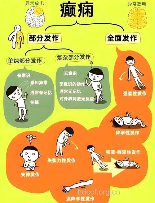 癫痫治疗过程中存在的误区