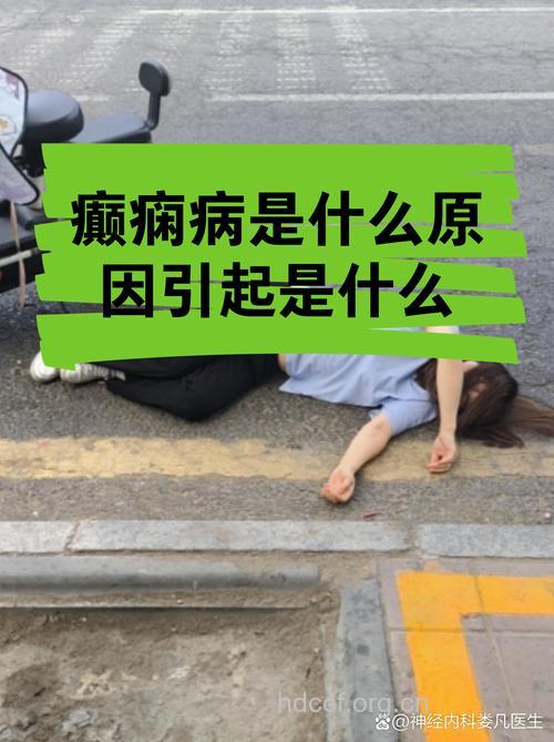 上网成癫痫致病因素