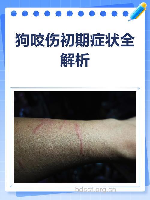 狗咬了艾滋病人后会传播艾滋病吗