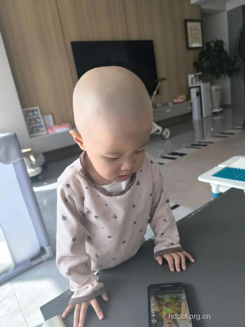 夏季宝宝可以剃光头吗
