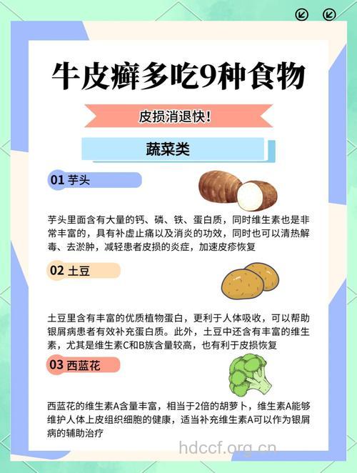 牛皮癣的食物辅助治疗