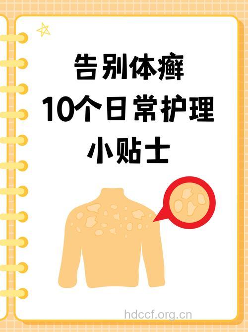 预防体藓要注意的7个习惯