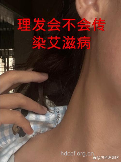 理发会感染艾滋病吗