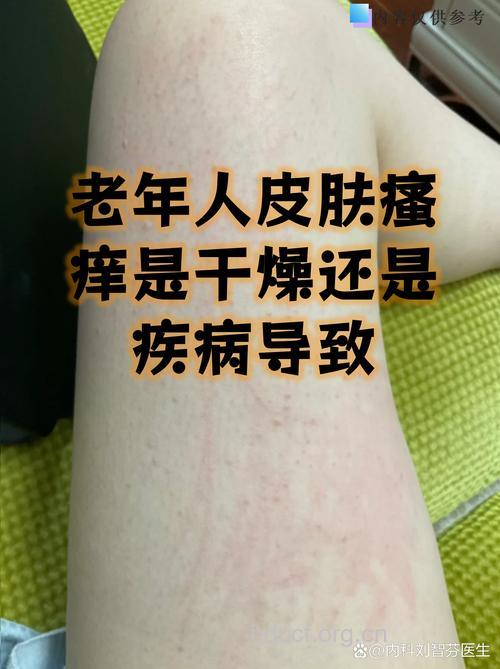 老人皮肤瘙痒,都是洗澡惹的祸