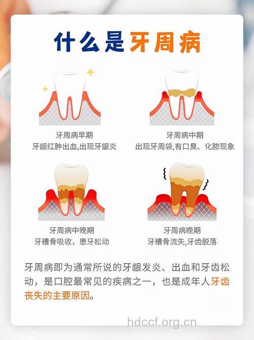 4个方法预防老人出现牙周炎