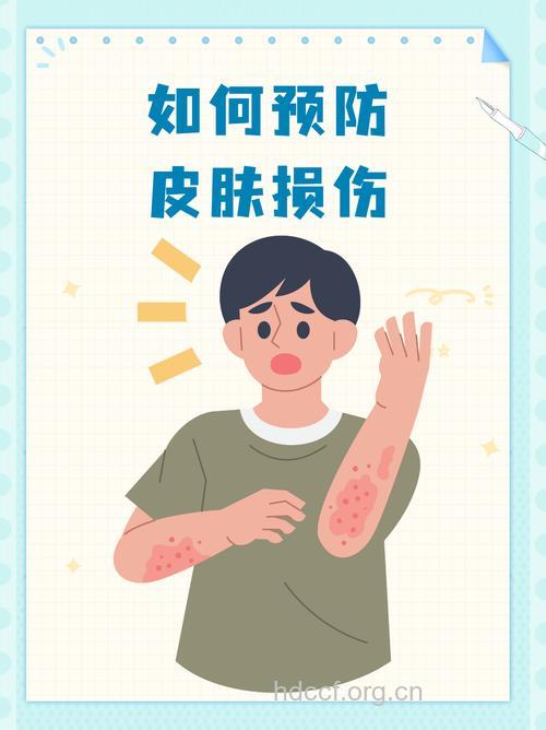 防皮肤病应保持清洁避免外伤
