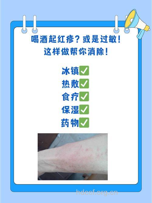 秋天多饮茶远离皮肤过敏