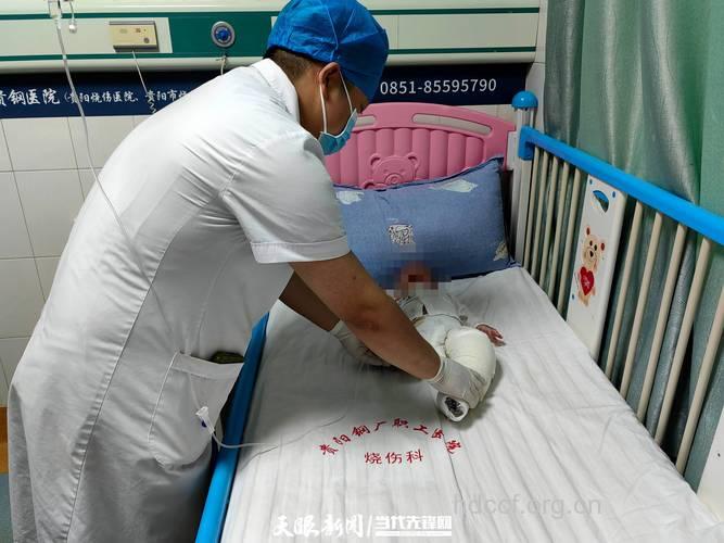 四月婴儿严重烫伤生命垂危