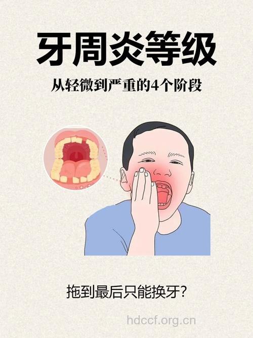常见牙周炎的三大症状表现
