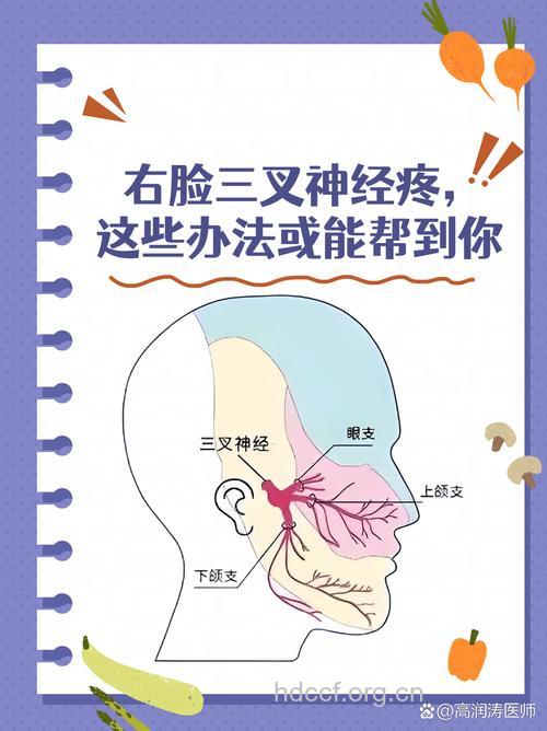 引起三叉神经痛的原因