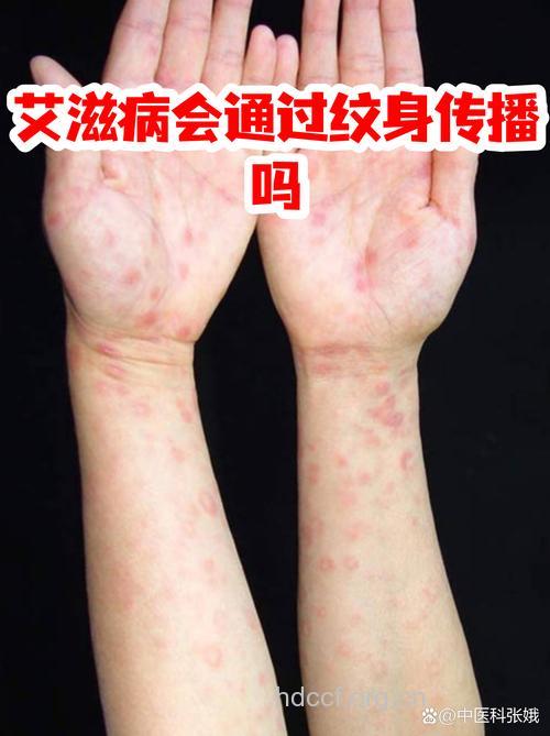 纹身传播艾滋病病毒的几率
