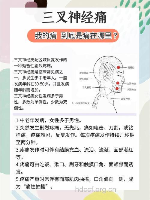 三叉神经痛发病病因是什么呢