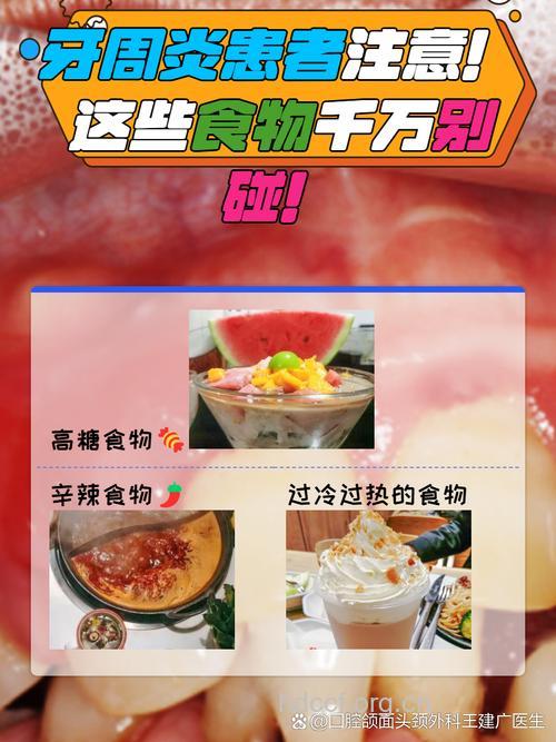 牙周炎患者多吃什么食物好