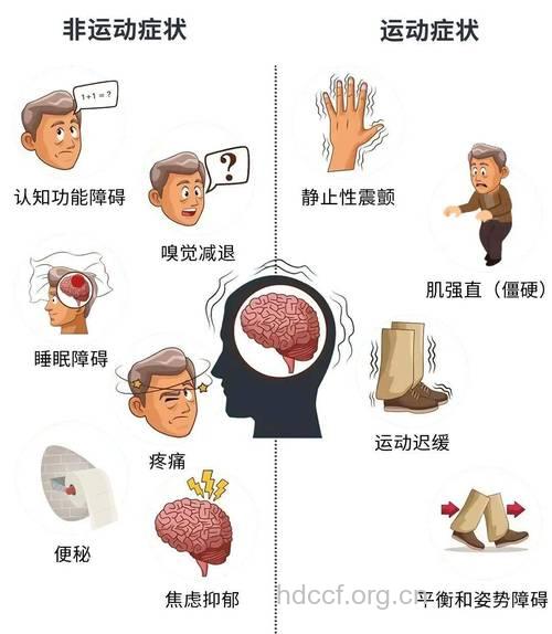 探究帕金森的症状与病因