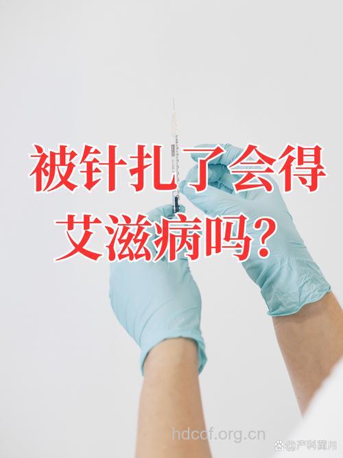 针刺会被传染艾滋病毒吗？