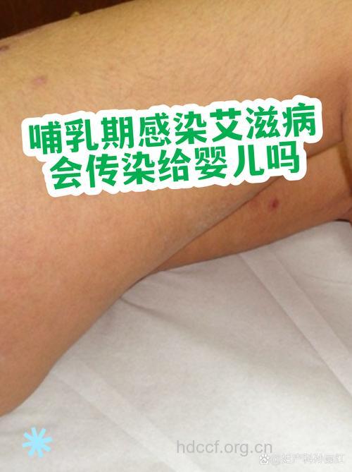 小心：母乳也会传播艾滋病