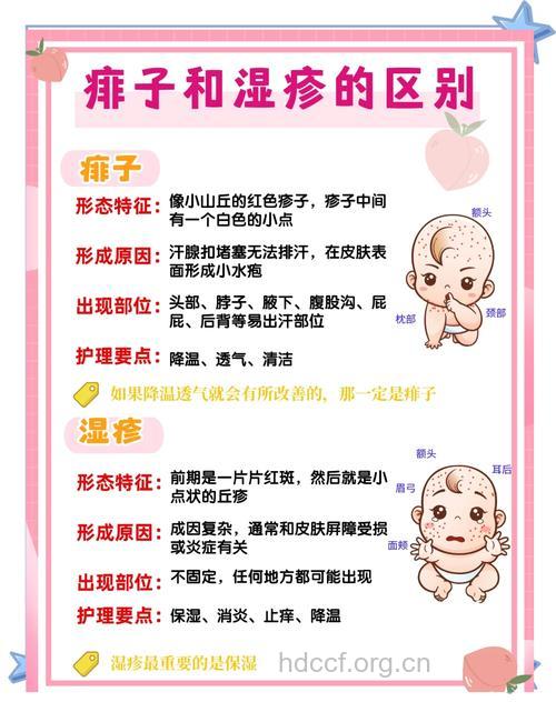 酷夏 学学如何预防防痱子