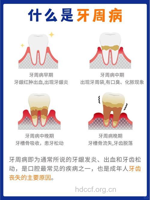 年纪轻轻就牙齿松动 谨防牙周炎的危害
