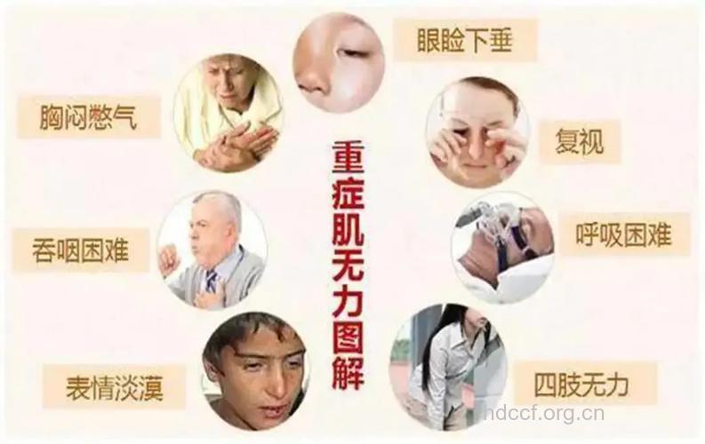 重症肌无力的五大病因
