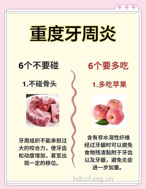 牙周炎饮食 牙周炎吃什么好