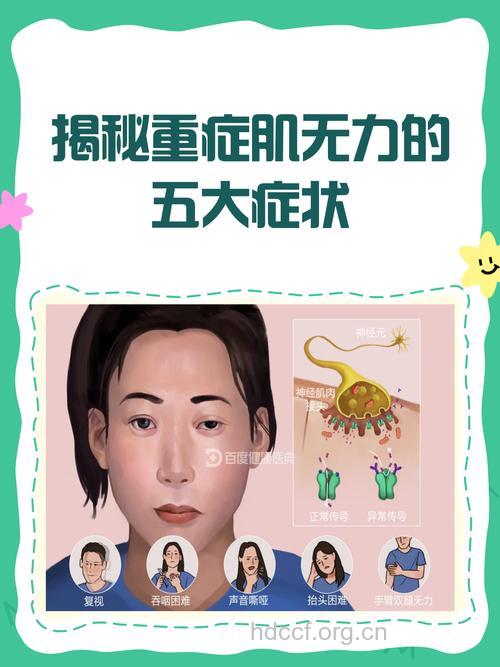 重症肌无力有哪些征兆呢